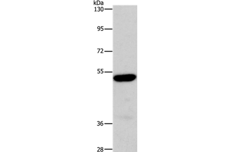 ARSB Antibody from Signalway Antibody (37428) - Antibodies.com
