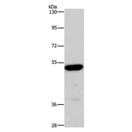 ARSB Antibody from Signalway Antibody (37428) - Antibodies.com