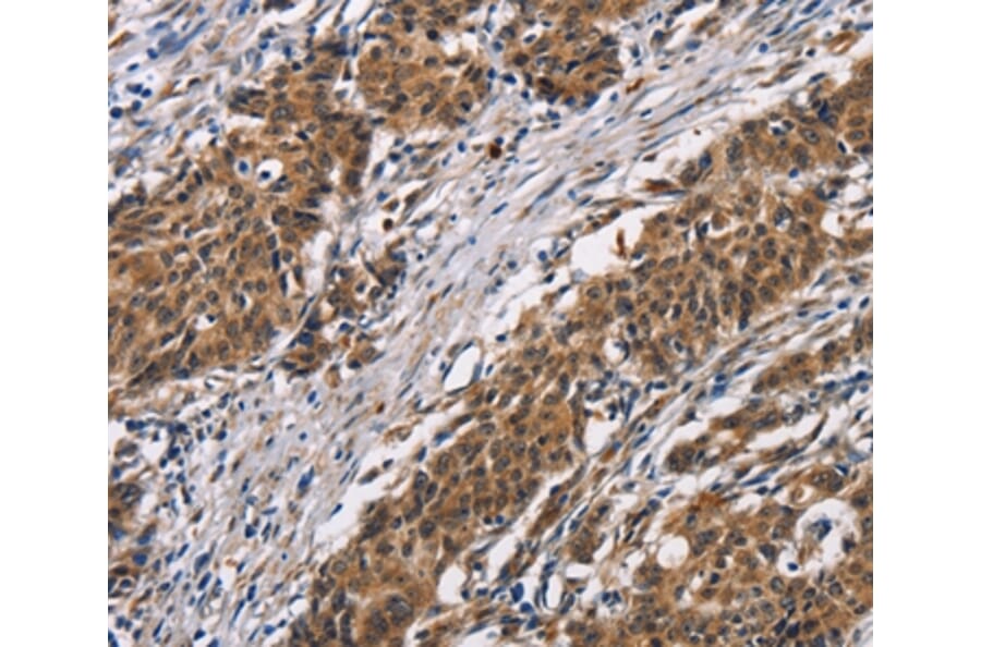 Immunohistochemistry - ARSB Antibody from Signalway Antibody (37428) - Antibodies.com