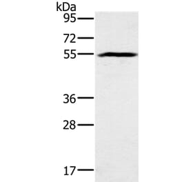 BMP6 Antibody from Signalway Antibody (37443) - Antibodies.com