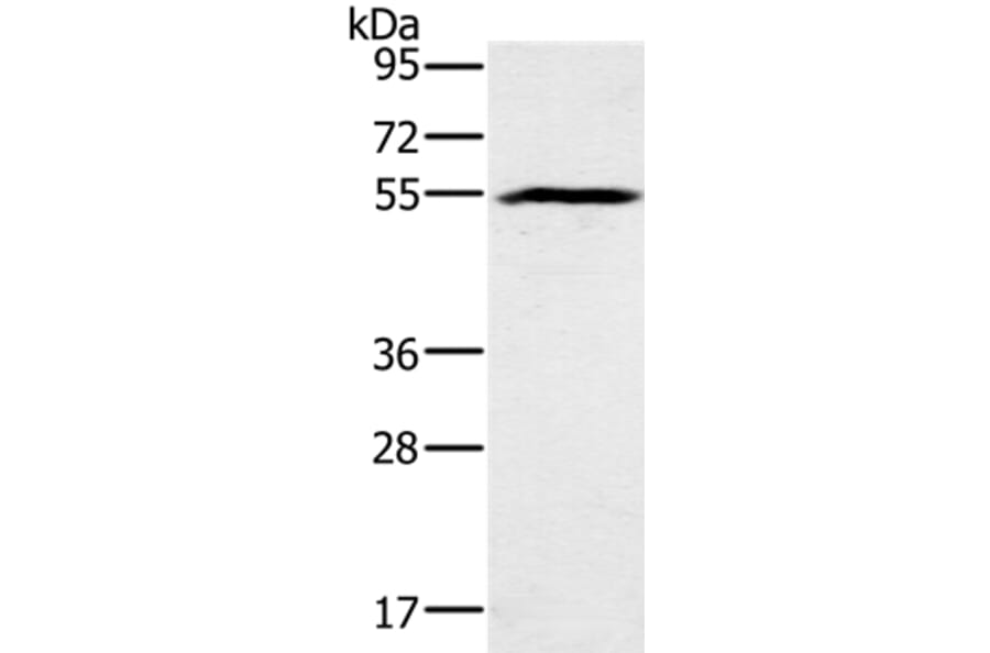BMP6 Antibody from Signalway Antibody (37443) - Antibodies.com