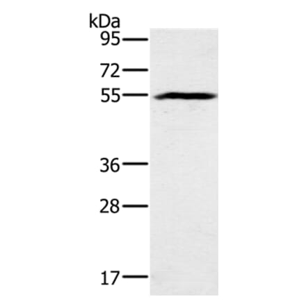 BMP6 Antibody from Signalway Antibody (37443) - Antibodies.com