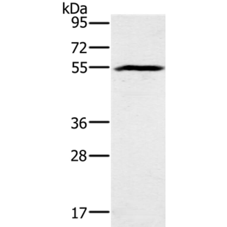 BMP6 Antibody from Signalway Antibody (37443) - Antibodies.com