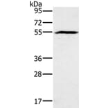 BMP6 Antibody from Signalway Antibody (37443) - Antibodies.com