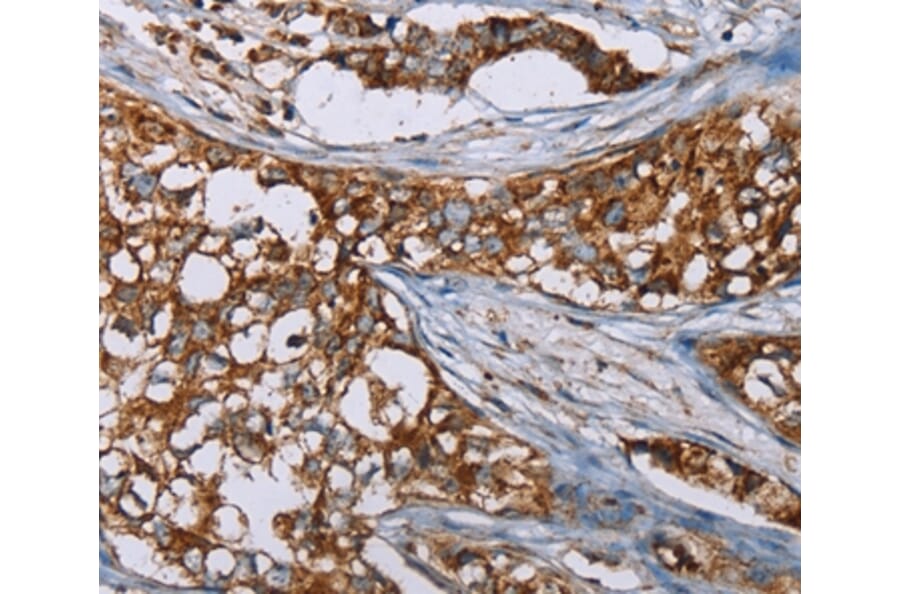 Immunohistochemistry - BMP6 Antibody from Signalway Antibody (37443) - Antibodies.com