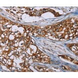 Immunohistochemistry - BMP6 Antibody from Signalway Antibody (37443) - Antibodies.com