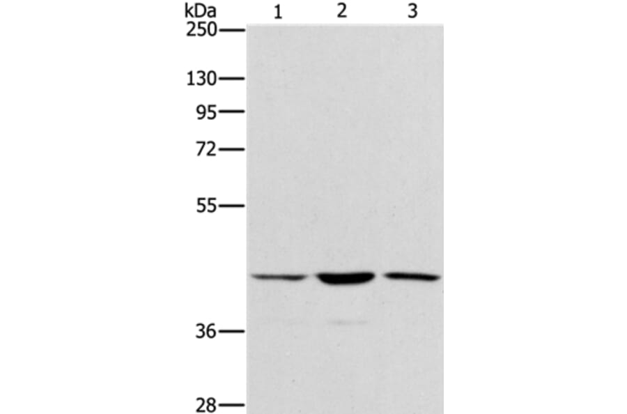 IBSP Antibody from Signalway Antibody (37446) - Antibodies.com
