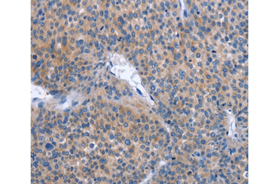Immunohistochemistry - IBSP Antibody from Signalway Antibody (37446) - Antibodies.com
