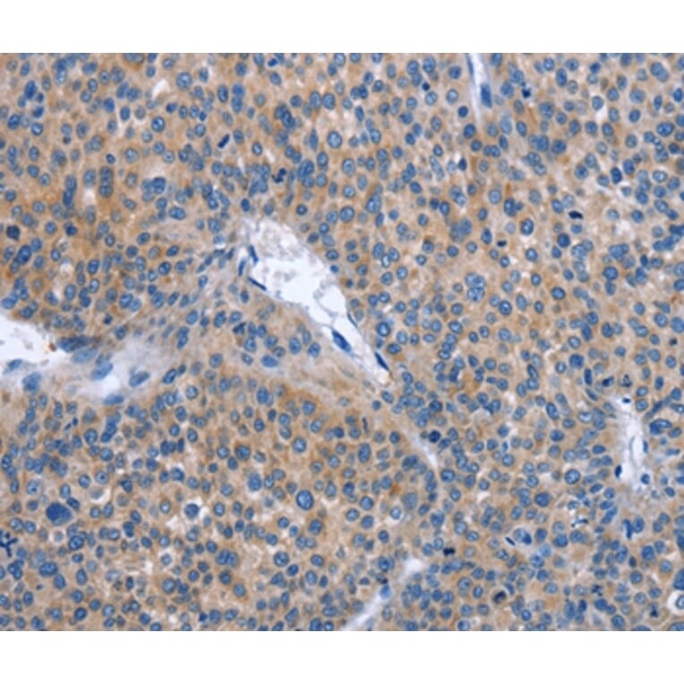 Immunohistochemistry - IBSP Antibody from Signalway Antibody (37446) - Antibodies.com