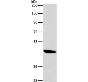 BRS3 Antibody from Signalway Antibody (37448) - Antibodies.com