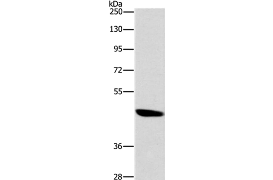BRS3 Antibody from Signalway Antibody (37448) - Antibodies.com