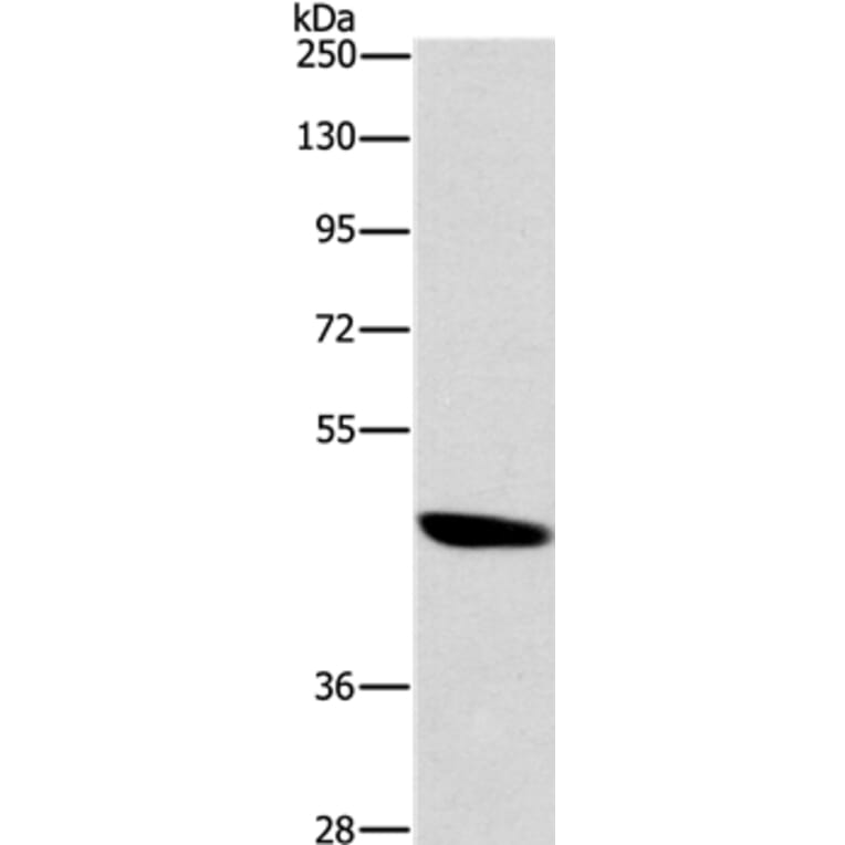 BRS3 Antibody from Signalway Antibody (37448) - Antibodies.com