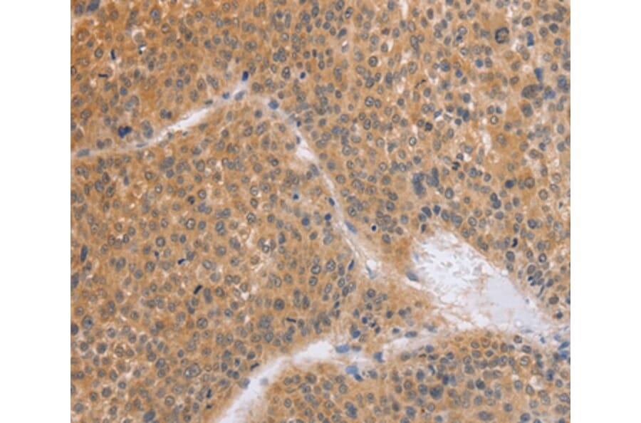 Immunohistochemistry - BRS3 Antibody from Signalway Antibody (37448) - Antibodies.com