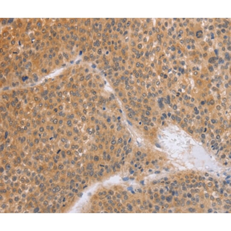 Immunohistochemistry - BRS3 Antibody from Signalway Antibody (37448) - Antibodies.com