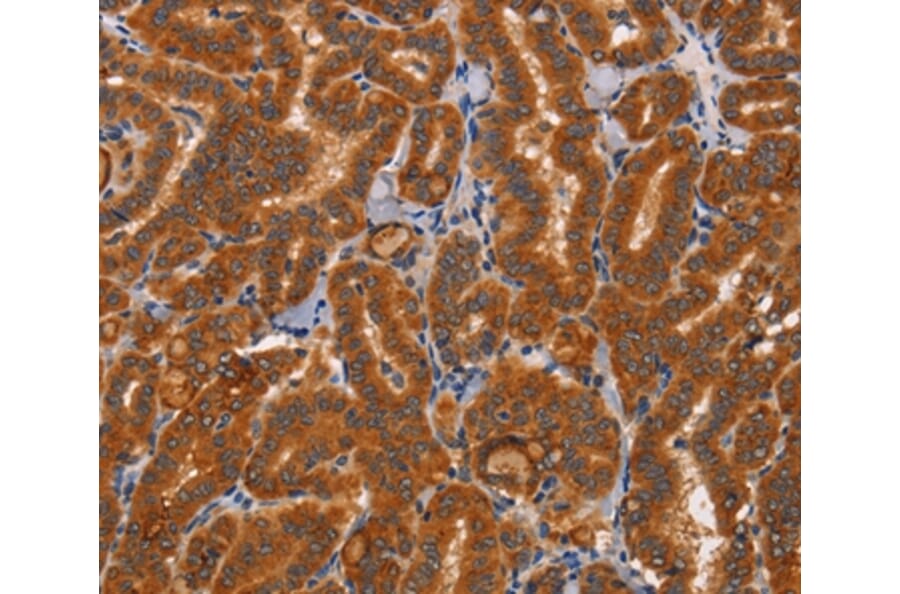 Immunohistochemistry - CTSC Antibody from Signalway Antibody (37463) - Antibodies.com