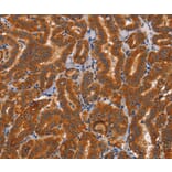 Immunohistochemistry - CTSC Antibody from Signalway Antibody (37463) - Antibodies.com