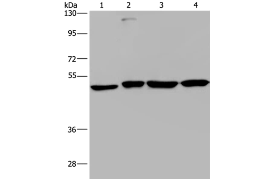 CCR6 Antibody from Signalway Antibody (37466) - Antibodies.com