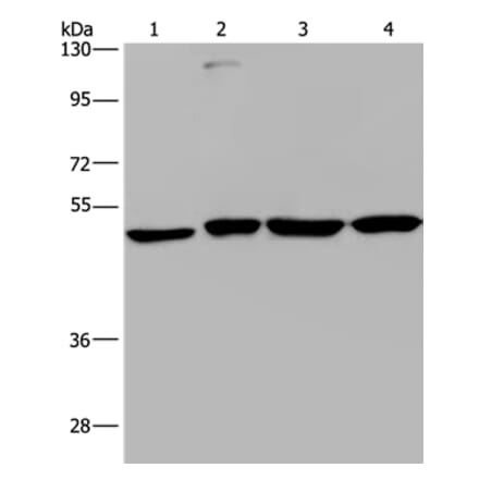 CCR6 Antibody from Signalway Antibody (37466) - Antibodies.com