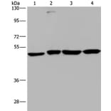 CCR6 Antibody from Signalway Antibody (37466) - Antibodies.com
