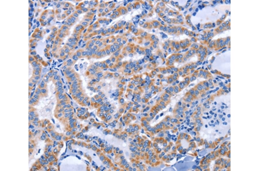 Immunohistochemistry - CCR6 Antibody from Signalway Antibody (37466) - Antibodies.com