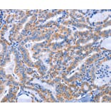 Immunohistochemistry - CCR6 Antibody from Signalway Antibody (37466) - Antibodies.com