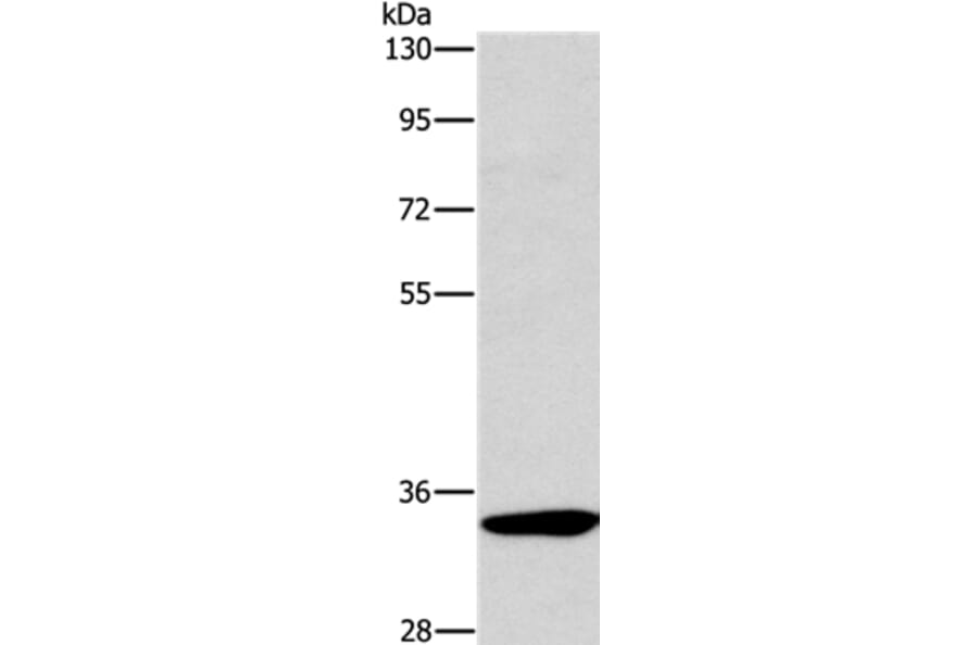 NCR1 Antibody from Signalway Antibody (37471) - Antibodies.com