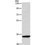 NCR1 Antibody from Signalway Antibody (37471) - Antibodies.com