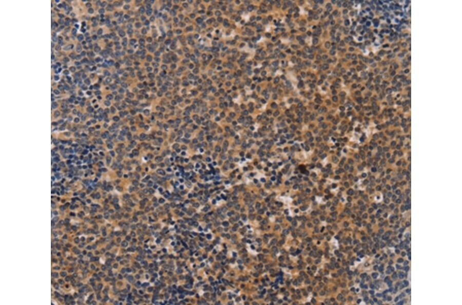 Immunohistochemistry - NCR1 Antibody from Signalway Antibody (37471) - Antibodies.com