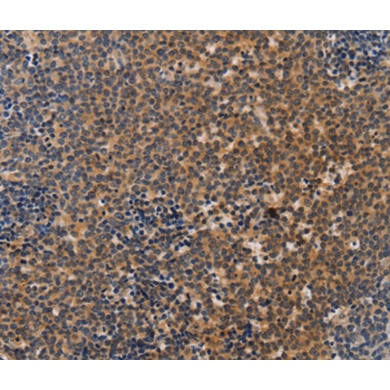 Immunohistochemistry - NCR1 Antibody from Signalway Antibody (37471) - Antibodies.com