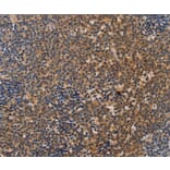 Immunohistochemistry - NCR1 Antibody from Signalway Antibody (37471) - Antibodies.com