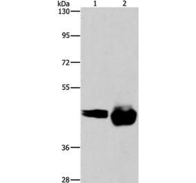 CD38 Antibody from Signalway Antibody (37474) - Antibodies.com