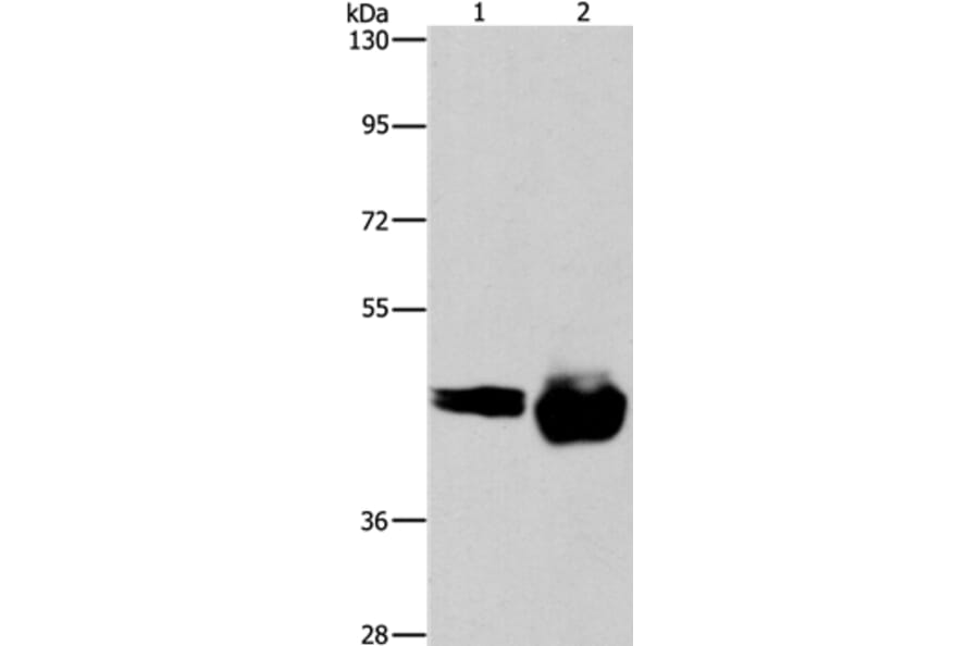 CD38 Antibody from Signalway Antibody (37474) - Antibodies.com
