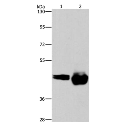 CD38 Antibody from Signalway Antibody (37474) - Antibodies.com