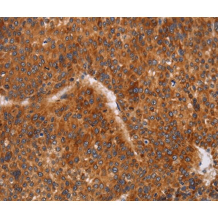Immunohistochemistry - CD38 Antibody from Signalway Antibody (37474) - Antibodies.com