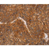 Immunohistochemistry - CD38 Antibody from Signalway Antibody (37474) - Antibodies.com