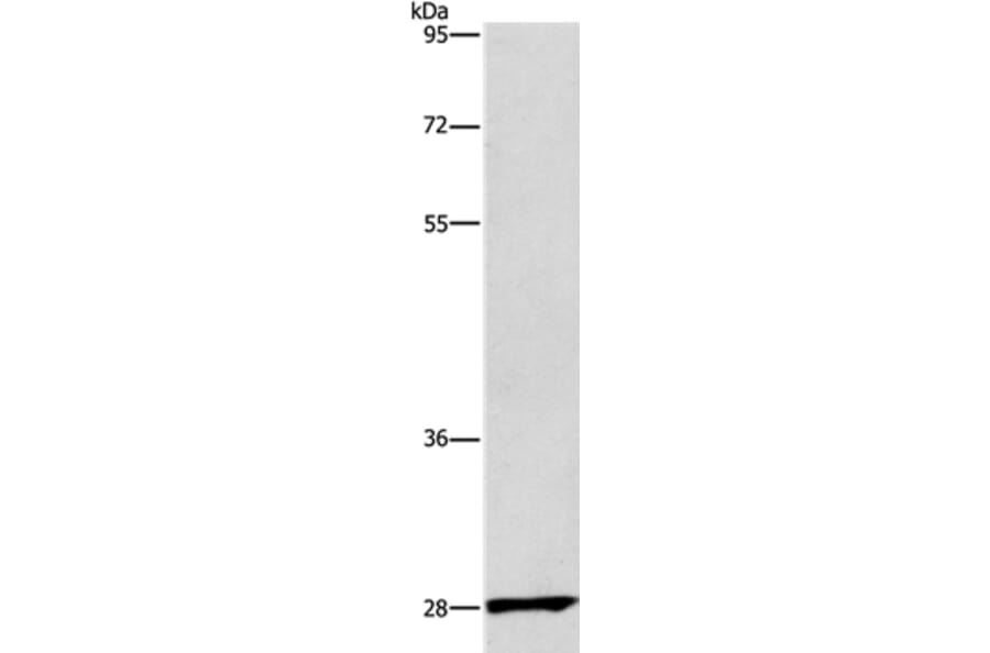 CD48 Antibody from Signalway Antibody (37475) - Antibodies.com