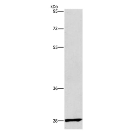 CD48 Antibody from Signalway Antibody (37475) - Antibodies.com