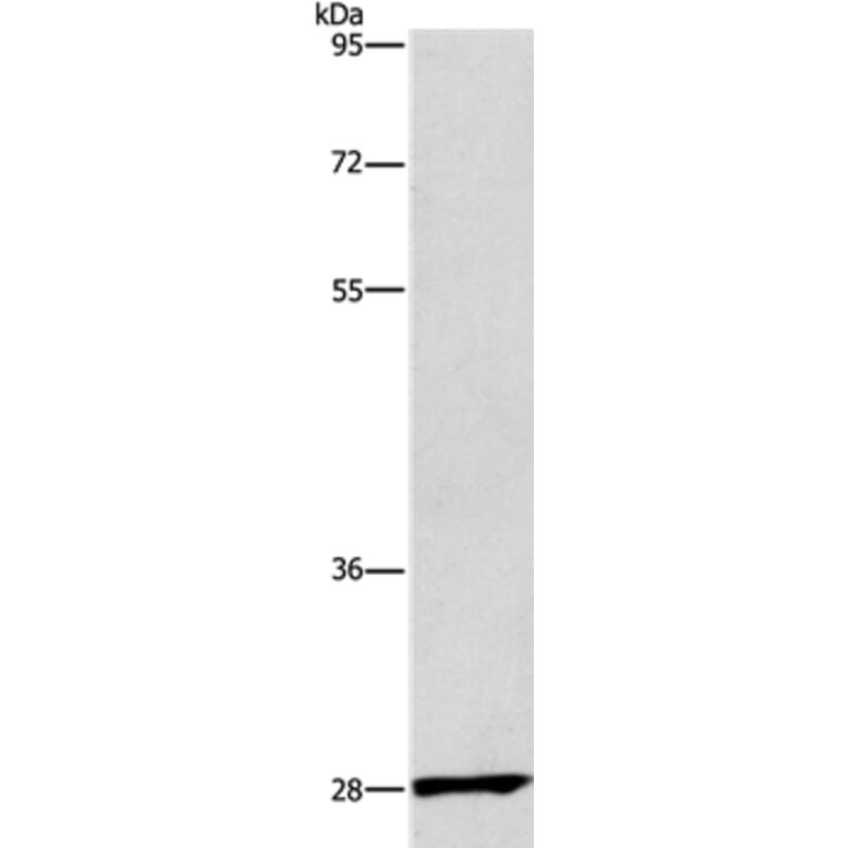 CD48 Antibody from Signalway Antibody (37475) - Antibodies.com