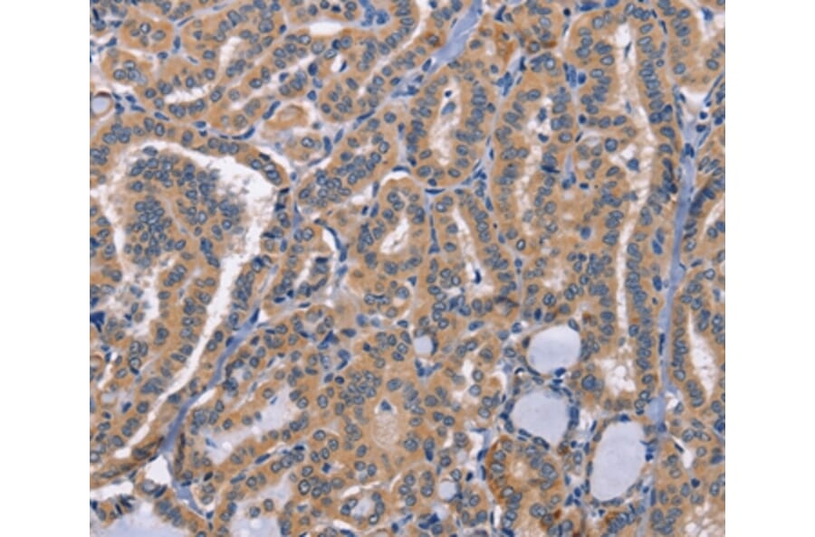 Immunohistochemistry - CD48 Antibody from Signalway Antibody (37475) - Antibodies.com