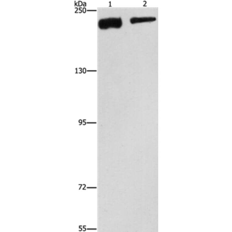 CLTC Antibody from Signalway Antibody (37491) - Antibodies.com
