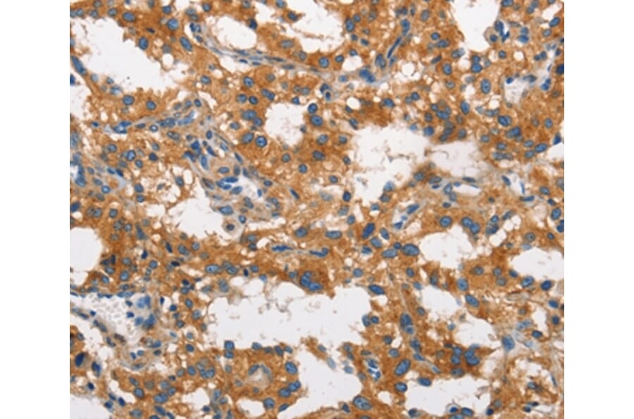 Immunohistochemistry - CLTC Antibody from Signalway Antibody (37491) - Antibodies.com