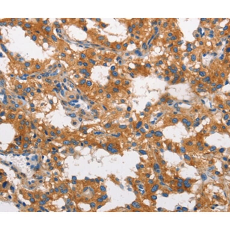 Immunohistochemistry - CLTC Antibody from Signalway Antibody (37491) - Antibodies.com