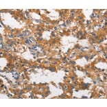 Immunohistochemistry - CLTC Antibody from Signalway Antibody (37491) - Antibodies.com