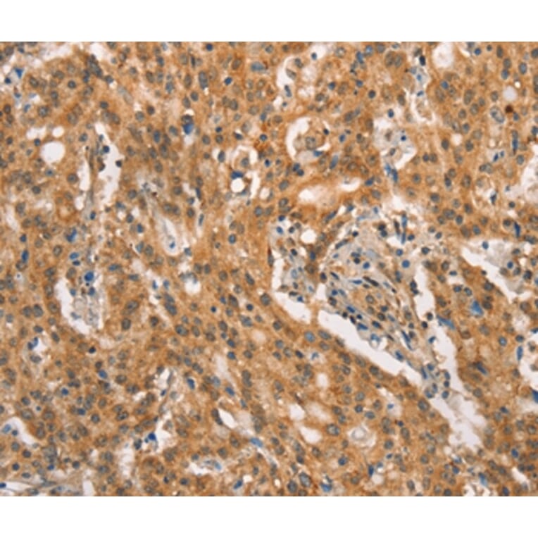 Immunohistochemistry - CRKL Antibody from Signalway Antibody (37507) - Antibodies.com