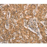 Immunohistochemistry - CRKL Antibody from Signalway Antibody (37507) - Antibodies.com