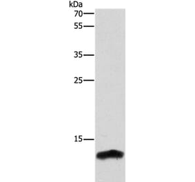 CSTB Antibody from Signalway Antibody (37516) - Antibodies.com