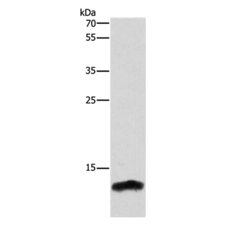 CSTB Antibody from Signalway Antibody (37516) - Antibodies.com