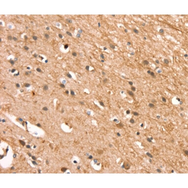 Immunohistochemistry - CSTB Antibody from Signalway Antibody (37516) - Antibodies.com