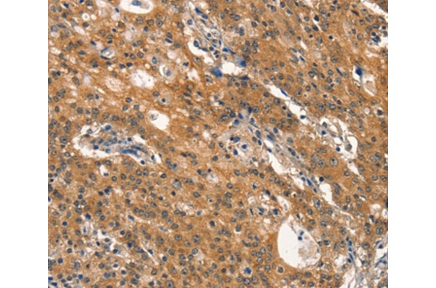 Immunohistochemistry - DNM2 Antibody from Signalway Antibody (37541) - Antibodies.com