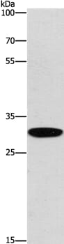 Gel: 8% SDS-PAGE Lysates (from left to right): Mouse kidney tissue Amount of lysate: 40ug per lane Primary antibody: 1/200 dilution Secondary antibody dilution: 1/8000 Exposure time: 1 minute